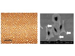 Nanostructured stainless steel surfaces and anchoring of osteoblast cells