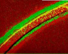 Premiers résultats en microscopie à émission des photoélectrons avec des rayons X (XPEEM)